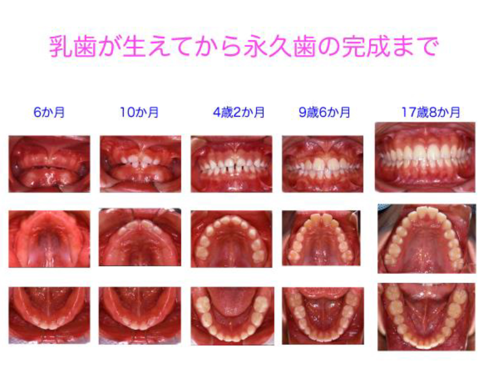 図9 乳歯が生えてから永久歯への交換、正常な永久歯列の完成