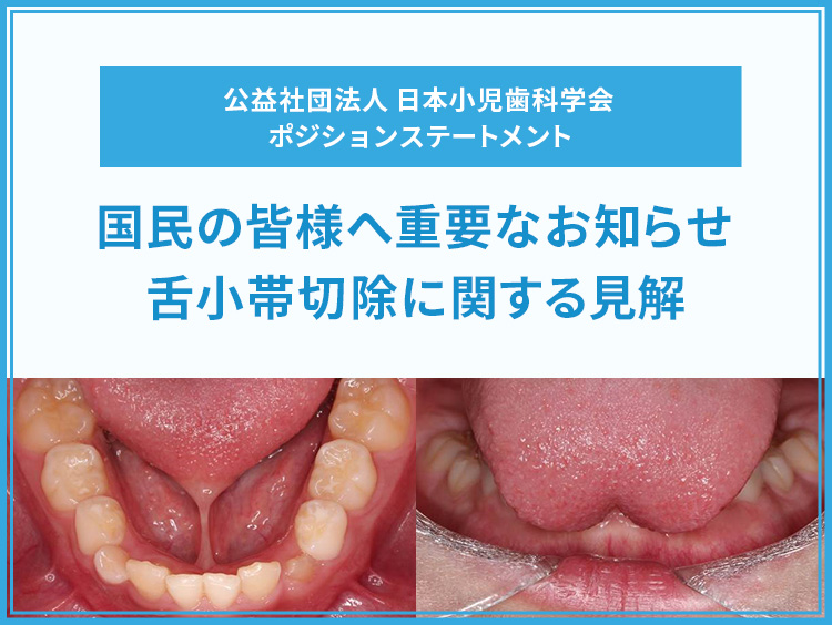 公益社団法人 日本小児歯科学会 ポジションステートメント 国民の皆様へ重要なお知らせ 舌小帯切除に関する見解